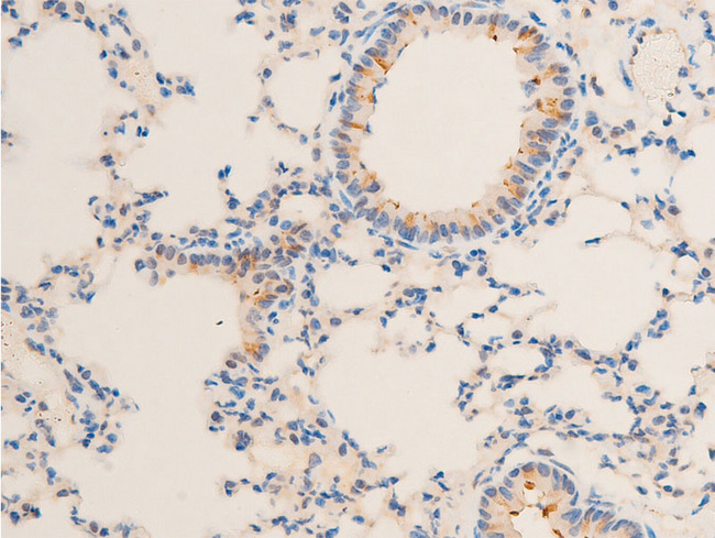 SGK1 / SGK Antibody - 1:100 staining mouse lung tissue by IHC-P. The tissue was formaldehyde fixed and a heat mediated antigen retrieval step in citrate buffer was performed. The tissue was then blocked and incubated with the antibody for 1.5 hours at 22°C. An HRP conjugated goat anti-rabbit antibody was used as the secondary.