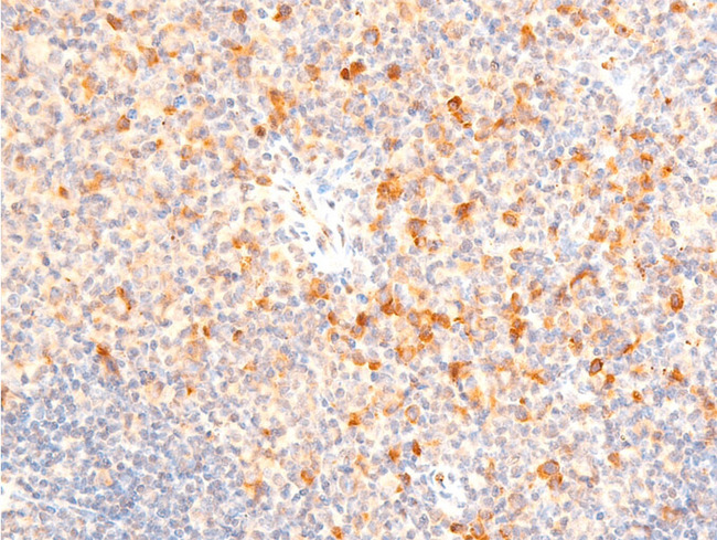 SGK1 / SGK Antibody - 1:100 staining mouse spleen tissue by IHC-P. The tissue was formaldehyde fixed and a heat mediated antigen retrieval step in citrate buffer was performed. The tissue was then blocked and incubated with the antibody for 1.5 hours at 22°C. An HRP conjugated goat anti-rabbit antibody was used as the secondary.