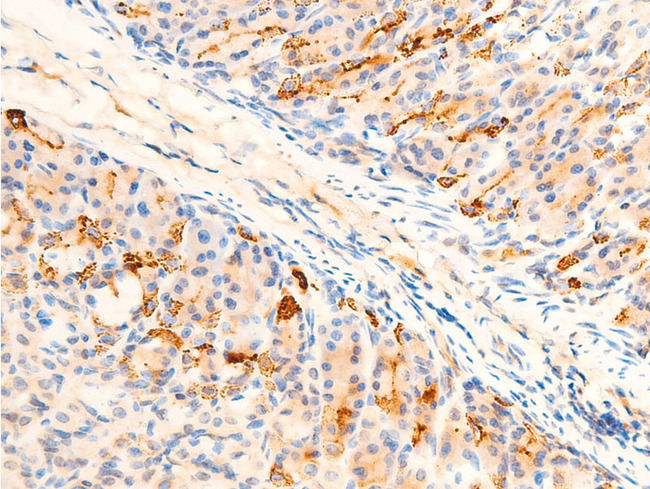 SGK1 / SGK Antibody - 1:100 staining mouse gastric tissue by IHC-P. The tissue was formaldehyde fixed and a heat mediated antigen retrieval step in citrate buffer was performed. The tissue was then blocked and incubated with the antibody for 1.5 hours at 22°C. An HRP conjugated goat anti-rabbit antibody was used as the secondary.