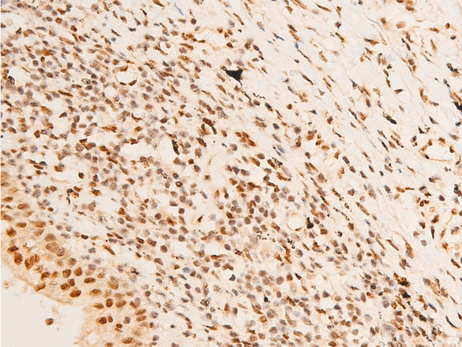 SGK1 / SGK Antibody - 1:100 staining human TB tissue by IHC-P. The tissue was formaldehyde fixed and a heat mediated antigen retrieval step in citrate buffer was performed. The tissue was then blocked and incubated with the antibody for 1.5 hours at 22°C. An HRP conjugated goat anti-rabbit antibody was used as the secondary.