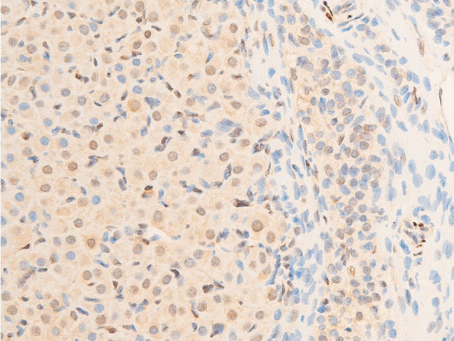 SGK1 / SGK Antibody - 1:100 staining rat ovarian tissue by IHC-P. The tissue was formaldehyde fixed and a heat mediated antigen retrieval step in citrate buffer was performed. The tissue was then blocked and incubated with the antibody for 1.5 hours at 22°C. An HRP conjugated goat anti-rabbit antibody was used as the secondary.