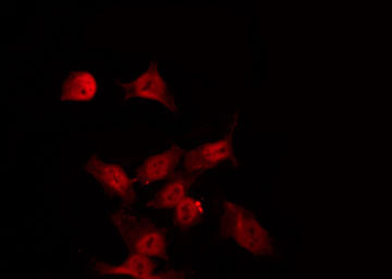 SGK1 / SGK Antibody - Staining HeLa cells by IF/ICC. The samples were fixed with PFA and permeabilized in 0.1% Triton X-100, then blocked in 10% serum for 45 min at 25°C. The primary antibody was diluted at 1:200 and incubated with the sample for 1 hour at 37°C. An Alexa Fluor 594 conjugated goat anti-rabbit IgG (H+L) Ab, diluted at 1/600, was used as the secondary antibody.