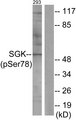 SGK1 / SGK Antibody - Western blot analysis of lysates from 293 cells treated with UV 15', using SGK (Phospho-Ser78) Antibody. The lane on the right is blocked with the phospho peptide.