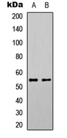 SGK1 / SGK Antibody - Western blot analysis of SGK1 (pS78) expression in HEK293T (A); A431 UV-treated (B) whole cell lysates.