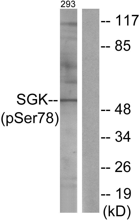 SGK1 / SGK Antibody - Western blot analysis of extracts from 293 cells, treated with UV (15mins), using SGK (Phospho-Ser78) antibody.