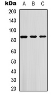 SGK1 / SGK Antibody - Western blot analysis of SGK1/2 (pT256/253) expression in HEK293T (A); Jurkat (B); NIH3T3 (C) whole cell lysates.