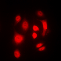 SGK1 / SGK Antibody - Immunofluorescent analysis of SGK1/2 (pT256/253) staining in HeLa cells. Formalin-fixed cells were permeabilized with 0.1% Triton X-100 in TBS for 5-10 minutes and blocked with 3% BSA-PBS for 30 minutes at room temperature. Cells were probed with the primary antibody in 3% BSA-PBS and incubated overnight at 4 deg C in a humidified chamber. Cells were washed with PBST and incubated with a DyLight 594-conjugated secondary antibody (red) in PBS at room temperature in the dark. DAPI was used to stain the cell nuclei (blue).