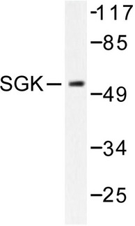 SGK1 / SGK Antibody - Western blot of SGK (P73) pAb in extracts from 293 cells treated with heat shock.