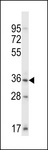 SGK110 Antibody - Mouse Sgk110 Antibody western blot of mouse testis tissue lysates (35 ug/lane). The Sgk110 antibody detected the Sgk110 protein (arrow).