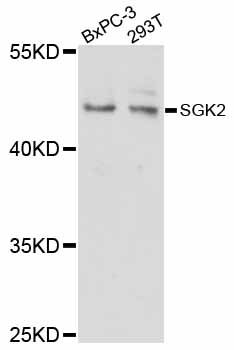 SGK2 Antibody - Western blot analysis of extracts of various cell lines, using SGK2 antibody at 1:1000 dilution. The secondary antibody used was an HRP Goat Anti-Rabbit IgG (H+L) at 1:10000 dilution. Lysates were loaded 25ug per lane and 3% nonfat dry milk in TBST was used for blocking. An ECL Kit was used for detection and the exposure time was 10s.