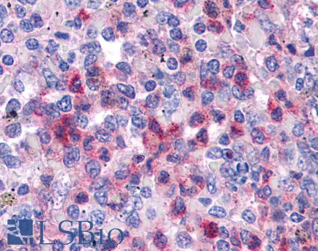 SGK3 Antibody - Anti-SGK3 antibody IHC of human spleen. Immunohistochemistry of formalin-fixed, paraffin-embedded tissue after heat-induced antigen retrieval. Antibody concentration 5 ug/ml.  This image was taken for the unconjugated form of this product. Other forms have not been tested.