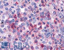SGK3 Antibody - Anti-SGK3 antibody IHC of human spleen. Immunohistochemistry of formalin-fixed, paraffin-embedded tissue after heat-induced antigen retrieval. Antibody concentration 5 ug/ml.  This image was taken for the unconjugated form of this product. Other forms have not been tested.