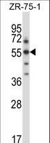 SGK3 Antibody - Mouse Sgk3 Antibody western blot of ZR-75-1 cell line lysates (35 ug/lane). The Sgk3 antibody detected the Sgk3 protein (arrow).
