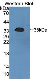 SGK3 Antibody - Western blot of SGK3 antibody.