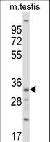 SGK494 Antibody - Mouse Sgk494 Antibody western blot of mouse testis tissue lysates (35 ug/lane). The Sgk494 antibody detected the Sgk494 protein (arrow).