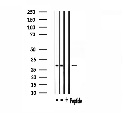 SGK494 Antibody - Western blot analysis of extracts of rta brain, rat spleen using SGK494 antibody.