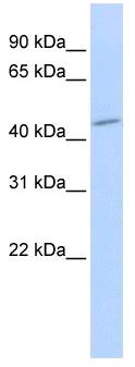 SGMS1 / TMEM23 Antibody - Western analysis of Hela cell lysate.  This image was taken for the unconjugated form of this product. Other forms have not been tested.