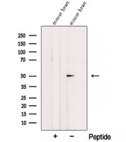 SGMS1 / TMEM23 Antibody - Western blot analysis of extracts of mouse heart tissue using SGMS1 antibody. The lane on the left was treated with blocking peptide.
