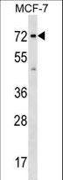 SGOL1 / Shugoshin Antibody - SGOL1 Antibody western blot of MCF-7 cell line lysates (35 ug/lane). The SGOL1 antibody detected the SGOL1 protein (arrow).