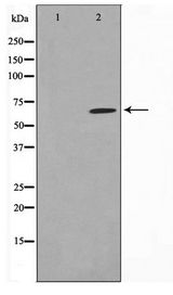 SGOL1 / Shugoshin Antibody - Western blot of HeLa cell lysate using SGOL1 Antibody