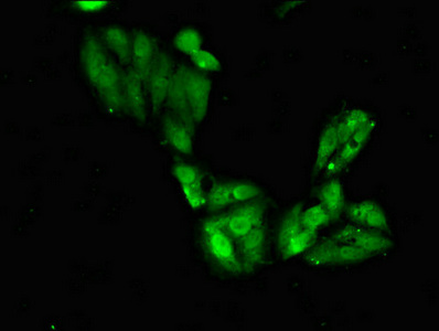 SGOL1 / Shugoshin Antibody - Immunofluorescent analysis of Hela cells diluted at 1:100 and Alexa Fluor 488-congugated AffiniPure Goat Anti-Rabbit IgG(H+L)