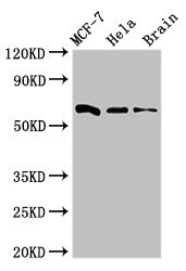 SGOL1 / Shugoshin Antibody - Western Blot Positive WB detected in:MCF-7 whole cell lysate,Hela whole cell lysate,Mouse brain tissue All Lanes:SGO1 antibody at 3µg/ml Secondary Goat polyclonal to rabbit IgG at 1/50000 dilution Predicted band size: 65,36,34,32,30,61,25 KDa Observed band size: 65 KDa