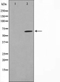 SGOL1 / Shugoshin Antibody - Western blot analysis on HeLa cell lysates using SGOL1 antibody. The lane on the left is treated with the antigen-specific peptide.