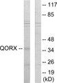 SGOL1 / Shugoshin Antibody - Western blot analysis of extracts from 293 cells, using QORX antibody.