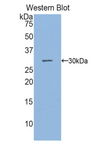 SGPL1 Antibody - Western blot of recombinant SGPL1.  This image was taken for the unconjugated form of this product. Other forms have not been tested.