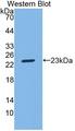 SGPL1 Antibody - Western blot of SGPL1 antibody.