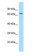 SGPL1 Antibody - SGPL1 antibody Western Blot of 721_B.  This image was taken for the unconjugated form of this product. Other forms have not been tested.