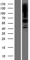 SGPL1 Protein - Western validation with an anti-DDK antibody * L: Control HEK293 lysate R: Over-expression lysate