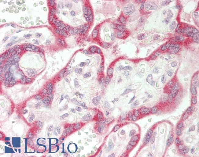 SGPP1 Antibody - Human Placenta: Formalin-Fixed, Paraffin-Embedded (FFPE).  This image was taken for the unconjugated form of this product. Other forms have not been tested.