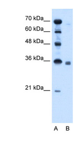 SGPP2 Antibody - SGPP2 antibody ARP45734_T100-XP_001128702-SGPP2(sphingosine-1-phosphate phosphotase 2) Antibody Western blot of HepG2 cell lysate.  This image was taken for the unconjugated form of this product. Other forms have not been tested.