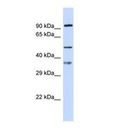 SGSH Antibody - Western blot of Human 721_B. SGSH antibody dilution 1.0 ug/ml.  This image was taken for the unconjugated form of this product. Other forms have not been tested.