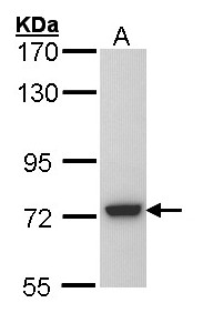 SGSH Antibody - Sample (30 ug of whole cell lysate). A: Molt-4 . 7.5% SDS PAGE. SGSH antibody diluted at 1:5000.
