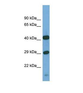 SGSH Antibody - Western blot of Human PANC1. SGSH antibody dilution 1.0 ug/ml.  This image was taken for the unconjugated form of this product. Other forms have not been tested.