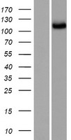 SGSM2 Protein - Western validation with an anti-DDK antibody * L: Control HEK293 lysate R: Over-expression lysate