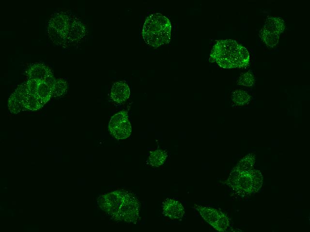 SGSM3 Antibody - Immunofluorescence staining of SGSM3 in MCF7 cells. Cells were fixed with 4% PFA, permeabilzed with 0.1% Triton X-100 in PBS, blocked with 10% serum, and incubated with rabbit anti-Human SGSM3 polyclonal antibody (dilution ratio 1:200) at 4°C overnight. Then cells were stained with the Alexa Fluor 488-conjugated Goat Anti-rabbit IgG secondary antibody (green). Positive staining was localized to Cytoplasm.