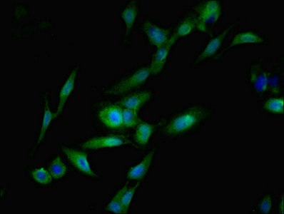 SGTA / SGT Antibody - Immunofluorescent analysis of Hela cells using SGTA Antibody at dilution of 1:100 and Alexa Fluor 488-congugated AffiniPure Goat Anti-Rabbit IgG(H+L)