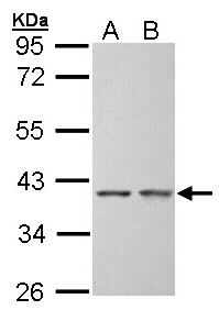 SGTA / SGT Antibody - Sample (30 ug of whole cell lysate). A: Hep G2 , B: Molt-4 . 10% SDS PAGE. SGTA / SGT antibody diluted at 1:5000.