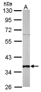 SGTA / SGT Antibody - Sample (50 ug of whole cell lysate). A: mouse liver. 10% SDS PAGE. SGTA / SGT antibody diluted at 1:1000.