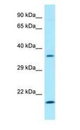 SGTA / SGT Antibody - SGTA / SGT antibody Western Blot of Fetal Heart.  This image was taken for the unconjugated form of this product. Other forms have not been tested.