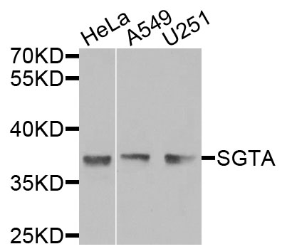 SGTA / SGT Antibody - Western blot analysis of extracts of various cells.