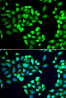SGTA / SGT Antibody - Immunofluorescence analysis of MCF7 cells.