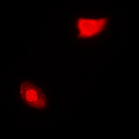 SGTA / SGT Antibody - Immunofluorescent analysis of SGTA staining in MCF7 cells. Formalin-fixed cells were permeabilized with 0.1% Triton X-100 in TBS for 5-10 minutes and blocked with 3% BSA-PBS for 30 minutes at room temperature. Cells were probed with the primary antibody in 3% BSA-PBS and incubated overnight at 4 deg C in a humidified chamber. Cells were washed with PBST and incubated with a DyLight 594-conjugated secondary antibody (red) in PBS at room temperature in the dark.