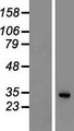 SGTB Protein - Western validation with an anti-DDK antibody * L: Control HEK293 lysate R: Over-expression lysate