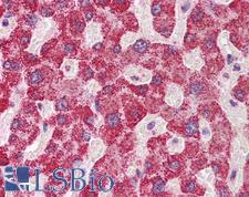 SH2B1 Antibody - Anti-SH2B1 antibody IHC of human liver. Immunohistochemistry of formalin-fixed, paraffin-embedded tissue after heat-induced antigen retrieval. Antibody concentration 5 ug/ml.  This image was taken for the unconjugated form of this product. Other forms have not been tested.