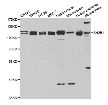 SH2B1 Antibody - Western blot analysis of extracts of various cell lines, using SH2B1 antibody.