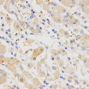 SH2B1 Antibody - Immunohistochemistry of paraffin-embedded human stomach using SH2B1 antibody at dilution of 1:200 (x400 lens)